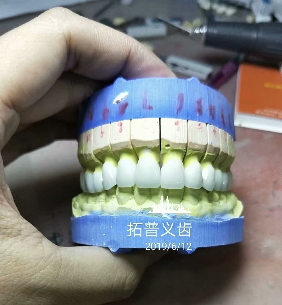 High Esthetics Zirconia Dental Lab Crowns Bridge With Layered Porcelain